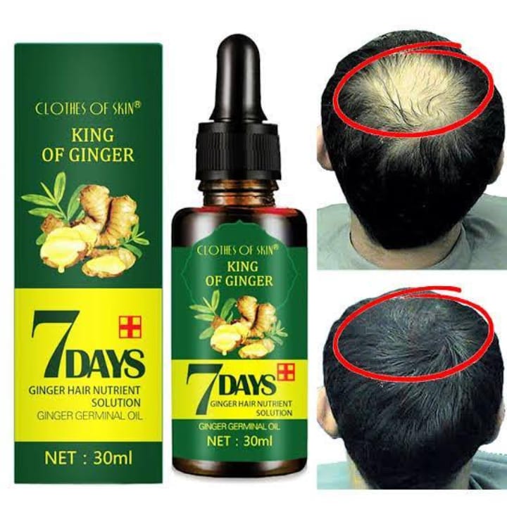 7 Days King of Ginger Hair Growth Oil – Anti Hair Loss & Hair Regrowth Serum (30ml)