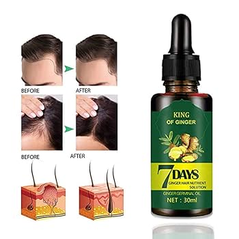7 Days King of Ginger Hair Growth Oil – Anti Hair Loss &amp; Hair Regrowth Serum (30ml)